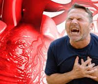 Can stress cause a heart attack?